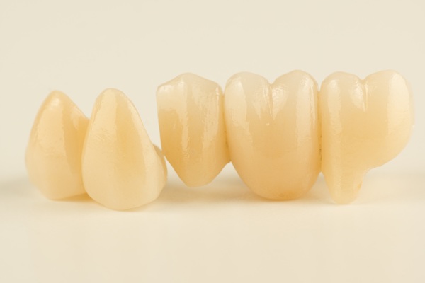 Tooth Replacement : Why A Dentist May Recommend A Dental Bridge