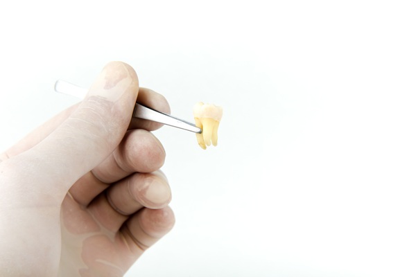 Wisdom Teeth Extraction: Signs You Need It And How To Prepare